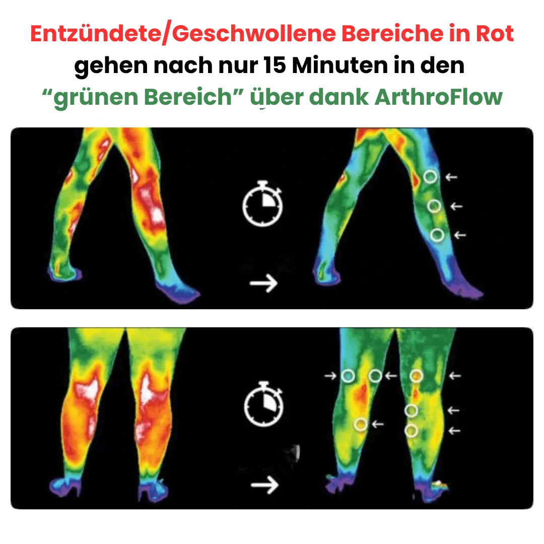 ArthroFlow - Linder deine Kniebeschwerden
